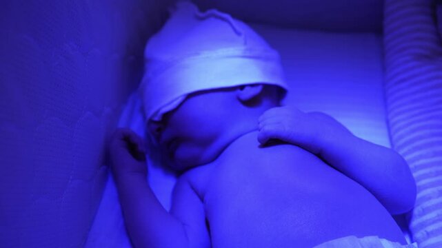 Adorable newborn baby with a white hat sleeping while receiving phototherapy treatment for jaundice, lying in a bed under a blue ultraviolet lamp to reduce high bilirubin levels