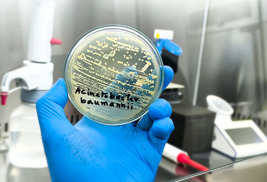 Microbiologist holding petri dish with bacterial collony of Acinetobacter Spp. Acinetobacter baumannii