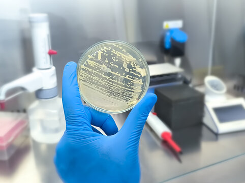 Microbiologist holding petri dish with bacterial collony of Acinetobacter Spp. Acinetobacter baumannii
