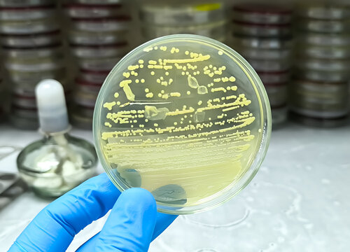 Microbiologist holding petri dish with bacterial collony of Acinetobacter Spp. Acinetobacter baumannii