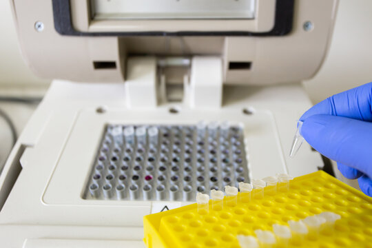 Small, heat-resistant plastic Eppendorf tubes for PCR testing on a thermal cycler. A scientist demonstrates which Eppendorf tubes are used for PCR.