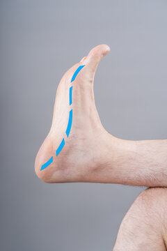 Flat feet or pes planus concept. Male foot with dashed line indicating medial arch shape. Podiatry and orthopedics diagnosis