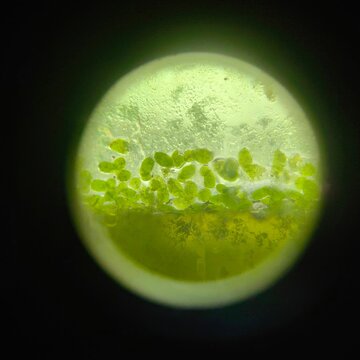 Microscopic View of Green Plant Cells or Algae