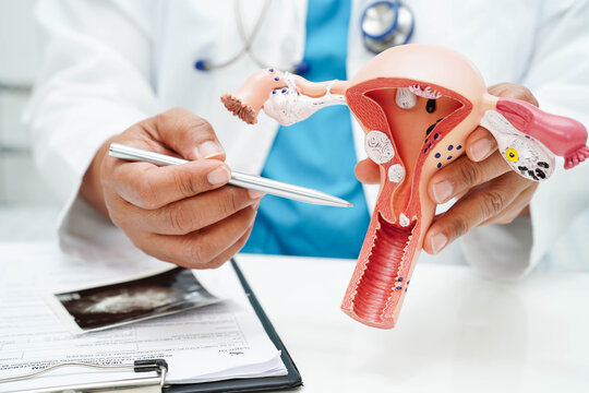 Uterus, Asian, woman holding human anatomy model.