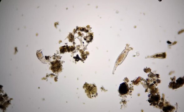 image of aquatic microorganisms under the microscope