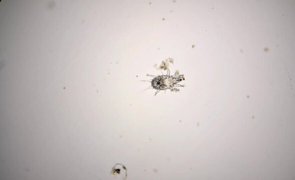 mite, microscope image