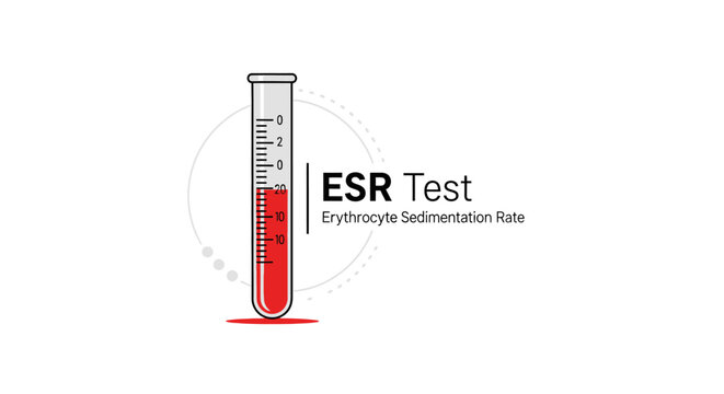 Flat design illustration of an ESR (Erythrocyte Sedimentation Rate) test tube, medical laboratory diagnostic blood analysis concept, isolated on white background.
