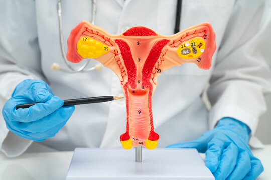 Uterus, doctor holding human anatomy model for study diagnosis and treatment in hospital.