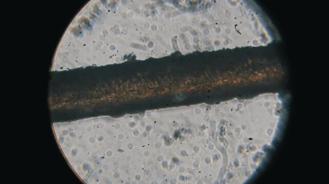 A single strand of human hair is examined under a microscope with bright backlighting. This macro shot reveals the texture and cuticle structure for trichology or biology analysis.