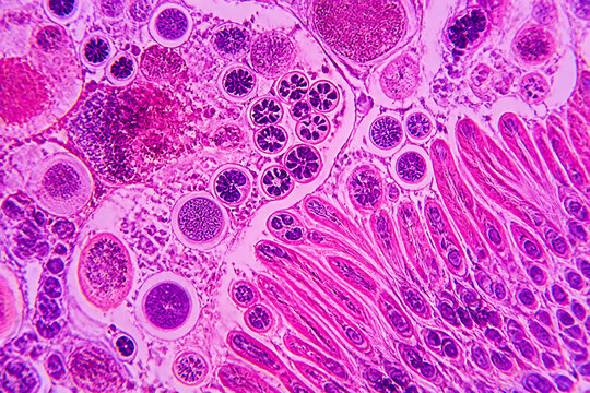Microscopic view of tissue exhibiting various cellular structures, including follicles and glandular tissue.