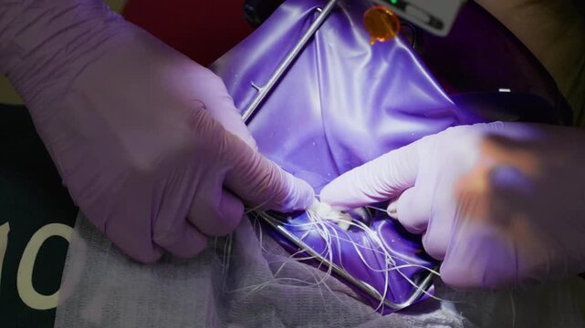 Skilled hands work meticulously in a sterile setting, preparing tools and materials for a delicate operation, highlighting the importance of precision and care in healthcare.