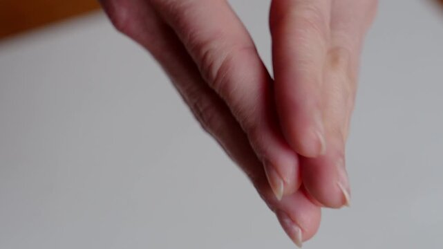 Damaged natural nails after gel polish removal
