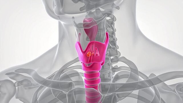 3D Medical Animation of Human Larynx Anatomy with Vocal Cord Nodule on Transparent Body Background