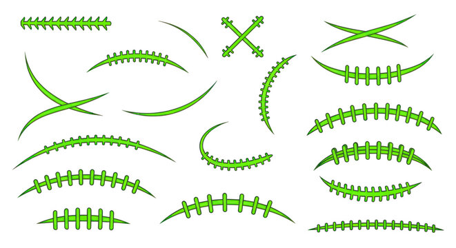 Green monster stitches and surgical suture scars collection