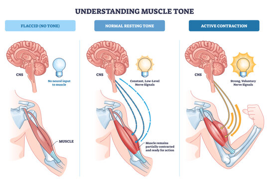 Muscle tone overview illustrates brain-CNS, nerve signals, and arm muscle across flaccid, resting, and active states, showing how neural input drives contraction, transparent background.