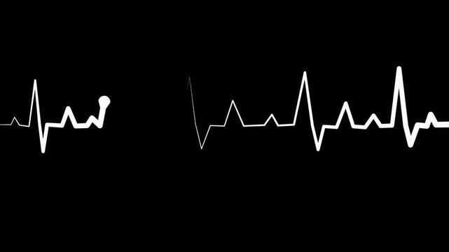 Heartbeat line on graph paper background,showing a medical electrocardiogram trace animation