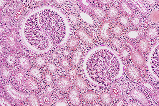 A micrograph of kidney tissue displaying glomeruli and renal tubules under a microscope.