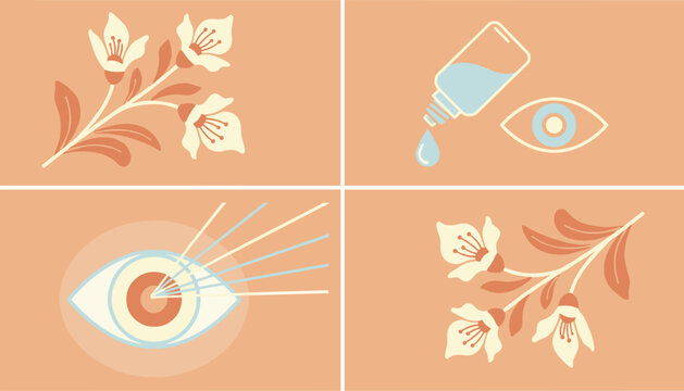 Eye care medical infographics showing natural flower ingredients, eye drop application, and laser surgery in a four-paneled design.