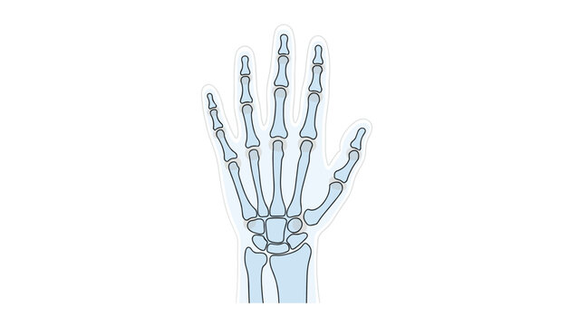 Stylized medical skeletal X-ray of a human hand showing individual finger bones and wrist joint structure on white background.