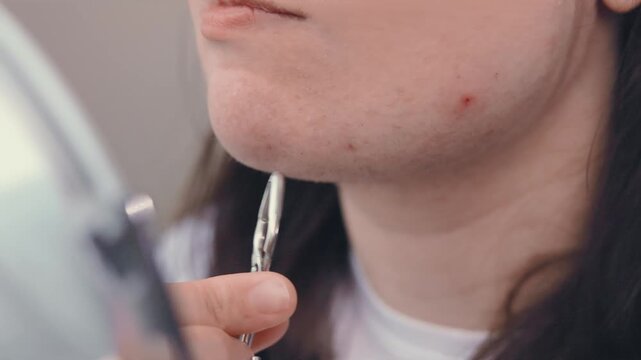 Close-up of a woman plucking unwanted chin hair with tweezers. This home beauty routine highlights female self-care, hormonal changes, and facial hair removal on problem skin. High quality 4k footage
