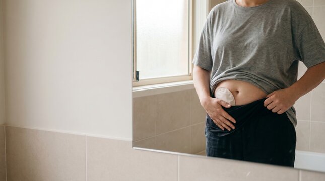 Adult person checking an ostomy pouch on the abdomen in a bathroom mirror, concept of stoma care, body confidence and life after bowel surgery.