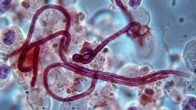 Ebola pathogen structure: filovirus shape, deadly germ, infectious agent, microscopic view, biological threat, cellular study, disease outbreak, global health.