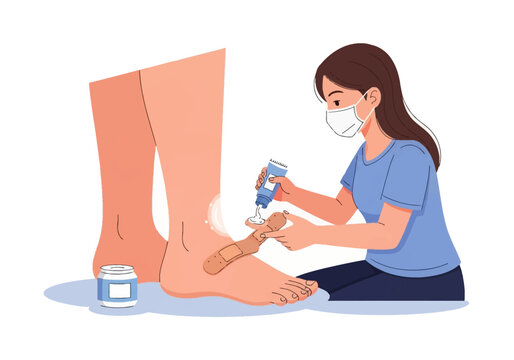 Vector illustration of a woman wearing a face mask applying medicinal ointment from a tube onto an adhesive bandage to treat a wound or callus on a person's ankle and heel.