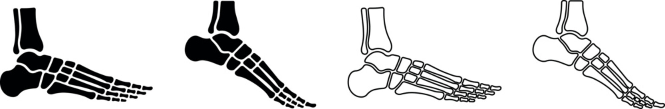 Anatomical illustrations of the human foot skeleton in profile view