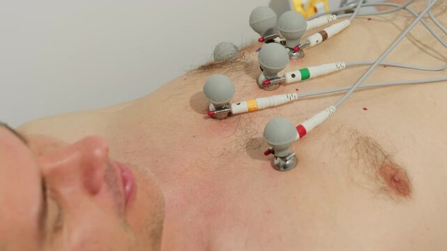 Shirtless man lies with electrode sensors attached across chest during cardiac test. Wires connect contact points recording body signals for diagnosis