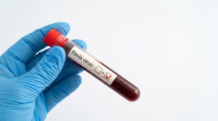 Obraz premium Distressed woman holding positive ebola virus blood test in laboratory setting