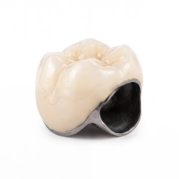 Generic porcelain fused to metal dental crown isolated on white.