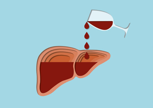 Alcoholic liver damage, conceptual illustration