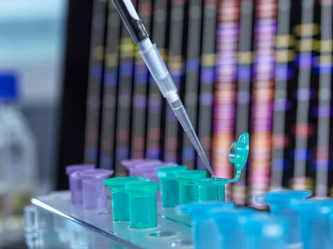 Laboratory pipette transferring liquid into a set of colorful microcentrifuge tubes.