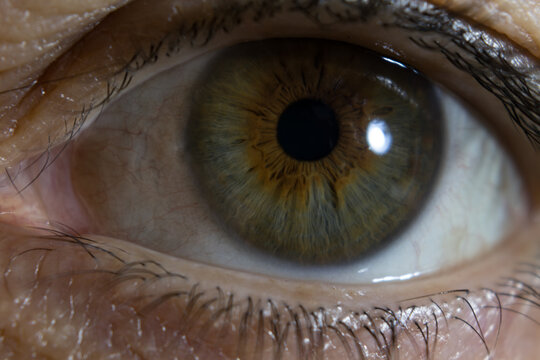 ojo