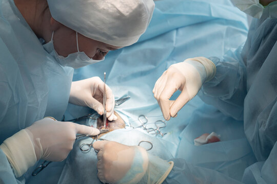 A skilled medical professional is focused on a surgical task inside a well-equipped operating room during a critical procedure. Sterile tools are used as they work with precision