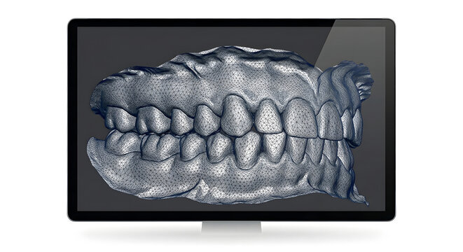 3D Dental STL Wireframe Model on Monitor Screen, Suitable for Science Education, Isolated on White Background