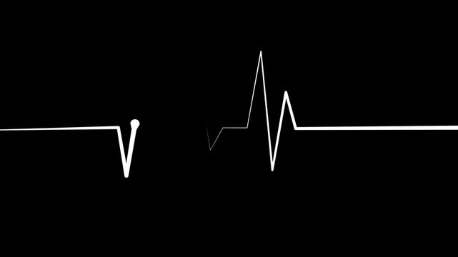 Ecg heartbeat line sharp pulse spike showing a medical monitor trace and a simple health care animation