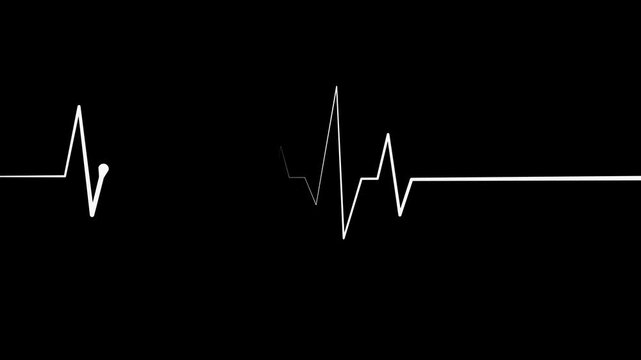 Heartbeat line pulse spike and flat line medical concept for heart health monitoring and emergency care animation