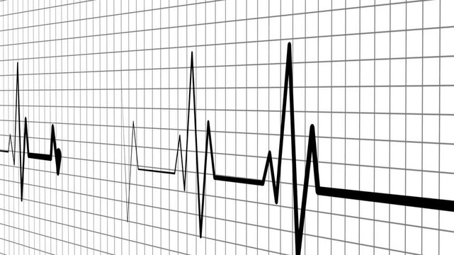 Electrocardiogram line heartbeat rhythm and medical monitor trace animation
