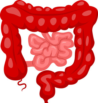 Bowel Surgery total proctocolectomy