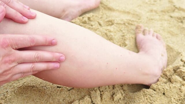woman examines insect bite on leg at sandy beach. red insect bite causes severe itching and allergic reaction. treating insect bite is common issue in tropical climate during summer.
