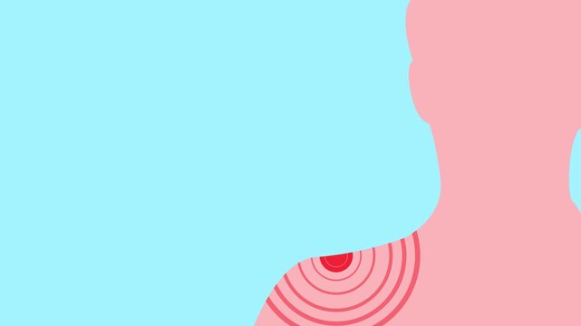 Shoulder pain, 2D animation. Massage, stiff joint and typing with employee person in workplace for fibromyalgia or osteoporosis
