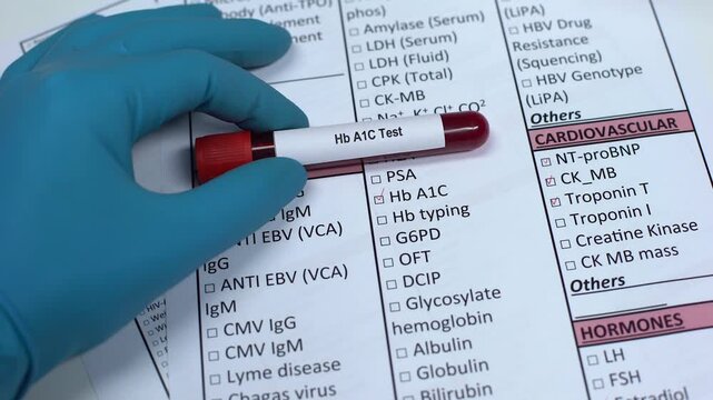 Close-up of a laboratory professional holding a blood sample tube labeled FSH (Follicle-Stimulating Hormone). Concept of inflammation testing, diagnostic pathology, and laboratory medicine.