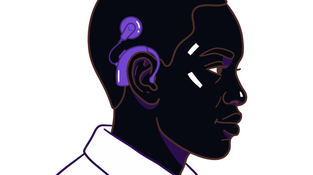 Illustration of a Black man wearing a purple cochlear implant for hearing assistance.