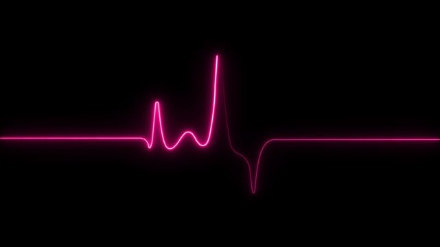 Heartbeat display animation 4k on motion graphics. Healtcare, medical or gym concept. 4k infinite loopable animation sequence.