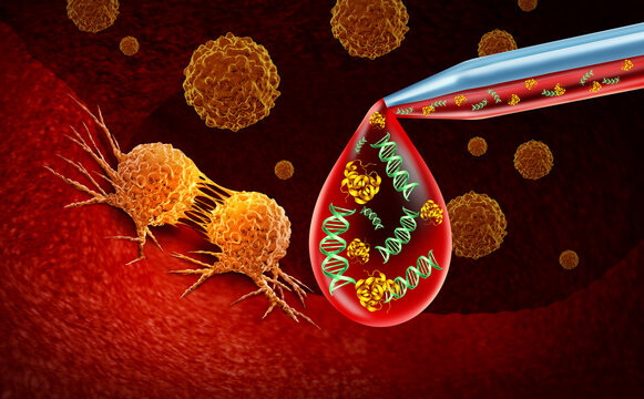 Multi cancer early detection or MCED as a liquid biopsy or cancer screening as early tumor detection and malignant diagnosis as a blood test with biomarkers as DNA and protein oncology biotechnology..