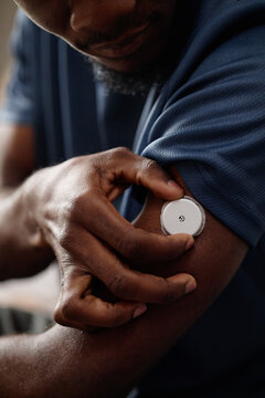 Vertical shot of Black young adult man applying continuous glucose monitor on upper arm, managing diabetes with wearable health technology. Ideal for telehealth, chronic care, patient education