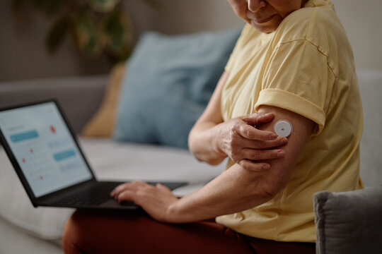 Senior woman checking glucose sensor on upper arm while using laptop at home, managing diabetes and remote health tracking. Ideal for telehealth, chronic care, wellness campaigns
