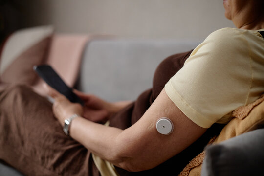 Middle aged woman checking smartphone while wearing glucose monitor on arm, tracking diabetes management at home. Close up for healthcare app, telemedicine, chronic care marketing