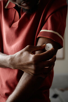 Vertical shot of Black young adult man applying glucose sensor on upper arm, managing diabetes with wearable health technology. Ideal for medical monitoring, chronic care
